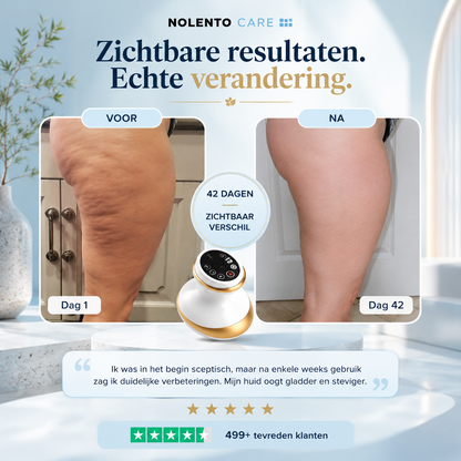 VelaSculpt™ Anti-Cellulite